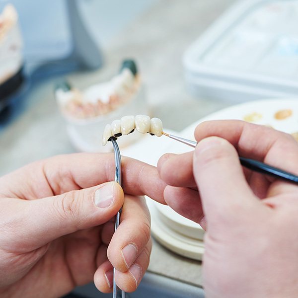 a lab technician crafting a dental restoration