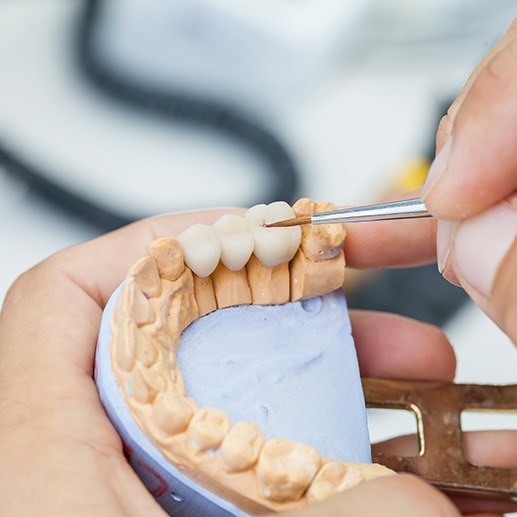 a lab technician crafting a dental bridge